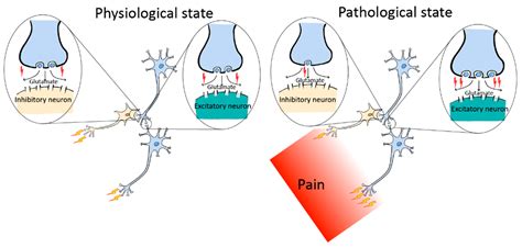 Neural Circuitry Polarization in the Spinal Dorsal Horn (SDH): A Novel ...