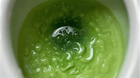 Why is your poop green: Common causes, studies, and when to worry