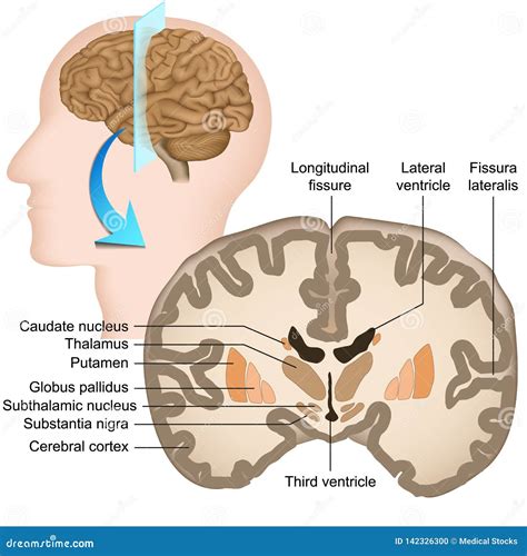 Coronal Section Of A Healthy Brain Showing Normal Anatomy Of Basal ...