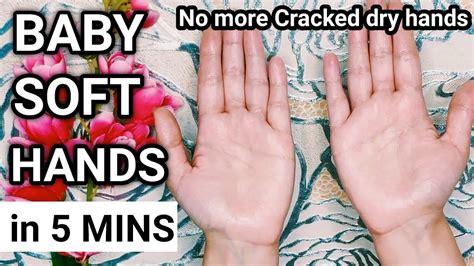 Why Are My Fingers So Dry And Cracking at Lois Boyd blog