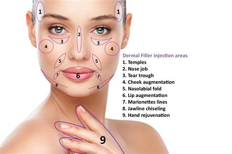 Dermal Fillers for lips, cheeks, nose, tear trough, jawline, hands and other areas of the face ...