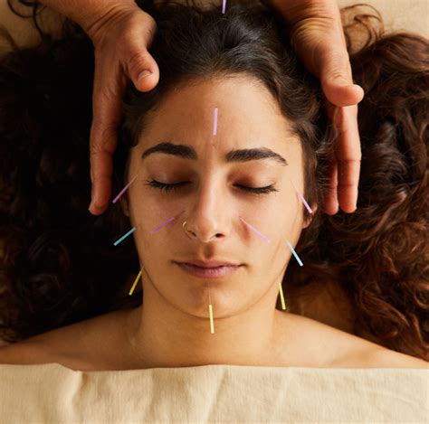 Acupuncture 的图像结果