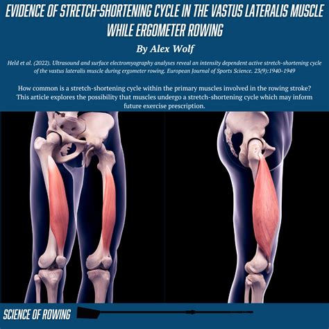 Vastus Lateralis Stretch Fibromyalgia Patients' Pain Not Linked To