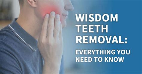 Image result for Remove Wisdom Teeth