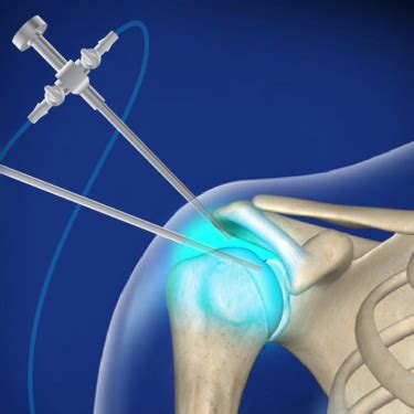 Shoulder Knee Specialist