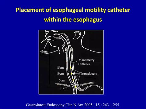 Classification of esophageal motility disorders | PPTX