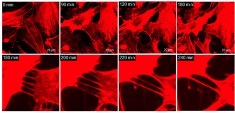 Effects of Netarsudil on Actin-Driven Cellular Functions in Normal and ...
