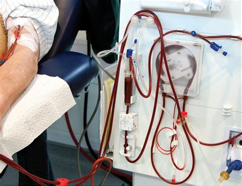 Global Continuous Renal Replacement Therapy Market Set for Exceptional Growth: Projected to ...