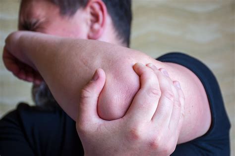 Ulnar Nerve Injury: Symptoms, Causes, Diagnosis, and Treatment