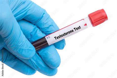 Testosterone Check 的图像结果