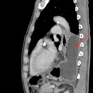 Pull Back Scan TOS 的图像结果