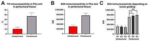 Clinical Outcomes Depending on Sympathetic Innervation in Pancreatic Cancer