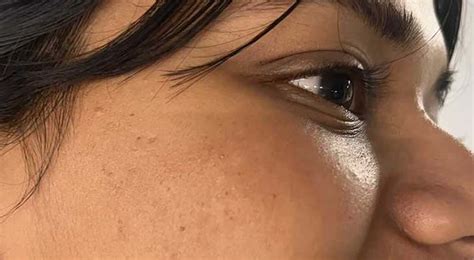 2% Salicylic Acid Serum Clear Skin Acne Pads with Matcha Tea - 40 N (x ...