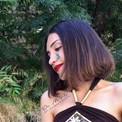 Facial Feminization Surgery - Dr. MFO in Turkey