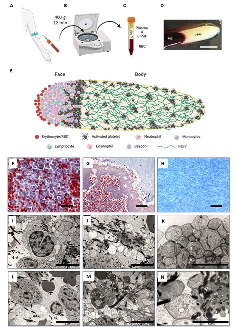 Image result for PRF Types