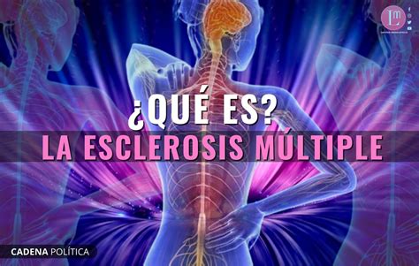 ¿QUÉ ES LA ESCLEROSIS MÚLTIPLE? » Latitud Megalópolis