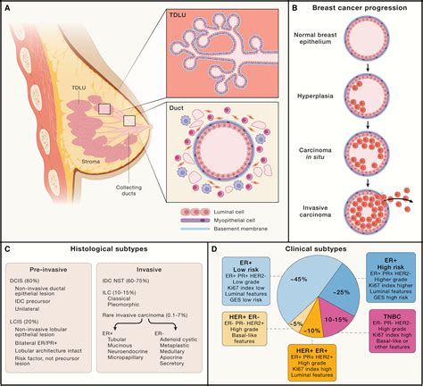 Understanding The Biology Of Breast Cancer: What Drives It