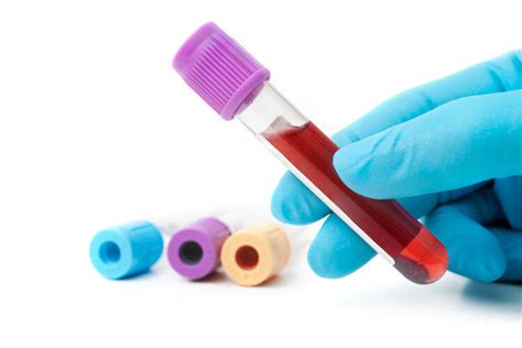 宁波献血网 工作动态 血情公布:A型血液库存紧缺、O型血液库存偏少，其他型血液库存正常（附8月22日-8月28日献血指引）