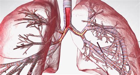 La bronquitis crónica es una afección respiratoria a largo plazo que afecta los bronquios y los ...