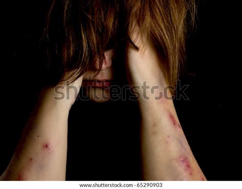 Image result for Examples of Mutilation