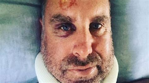 ऑस्ट्रेलियाई धुरंधर हेडन लहूलुहान, सर्फिंग के दौरान सिर में लगी चोट ...