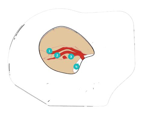 Surgical Simulation Models | Neuro-Oncology & ICG Angio