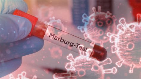 The Marburg Virus Is Back In Focus Thanks To A Ugandan Scientist, Here ...
