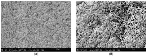 Scanning Electron Microscopy (SEM) Evaluation of the Ultrastructural ...