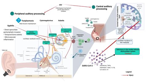 Frontiers | Pathophysiology and mechanisms of hearing impairment related to neonatal infection ...