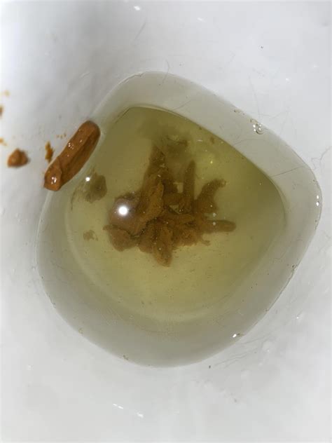 Soft thin stools ? Been constipated for while now just on going had fit tests normal having ...