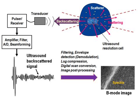 Hepatic Steatosis Assessment Using Quantitative Ultrasound Parametric ...