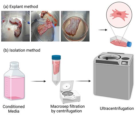 Extracellular Vesicles Derived from Human Umbilical Cord Mesenchymal ...