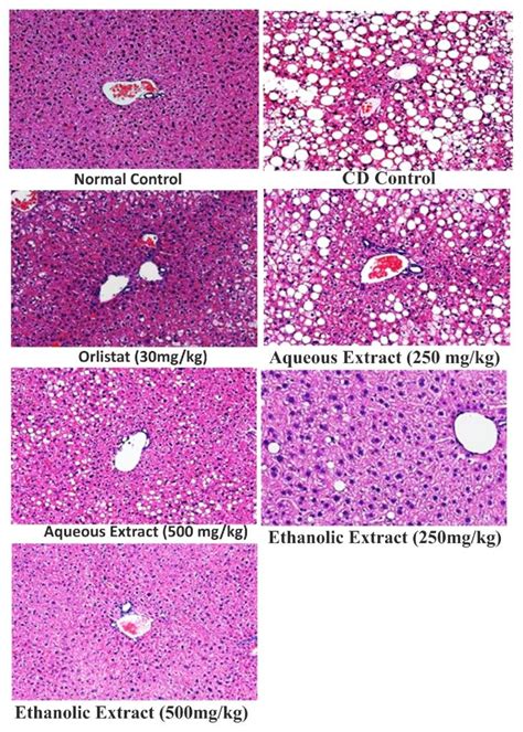 Preclinical Screening of Rubia cordifolia leaves extract for anti ...
