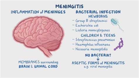 Meningitis (pediatrics): Clinical sciences - Osmosis Video Library