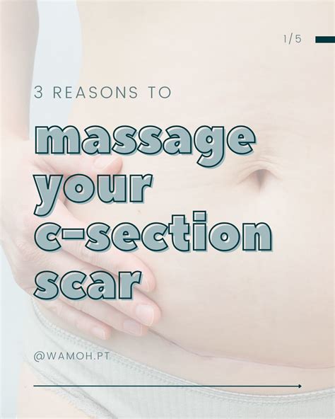 Jenni Gabelsberg, Pelvic Health Physical Therapist on LinkedIn: Why ...