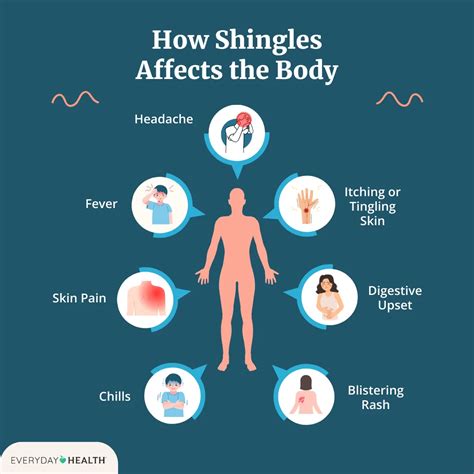 Shingles Early Symptoms Nhs