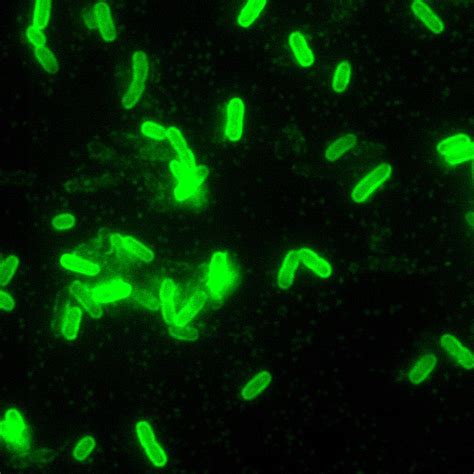 Free picture: yersinia pestis, direct, fluorescent, antibody, stain ...