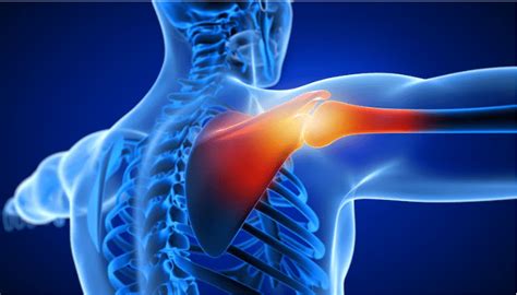 Exploring the Value: Is Shoulder Replacement Surgery Worth It? | MediBuddy
