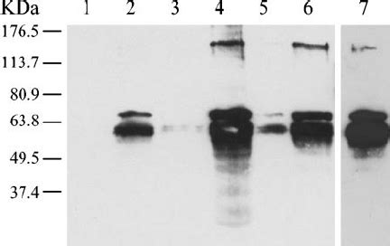 Western blot analysis of YueB polypeptides in membrane- enriched...