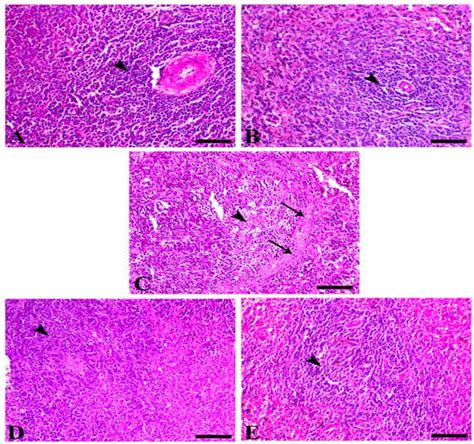 Biomedicines | Special Issue : Parasitic Infection and Immunity