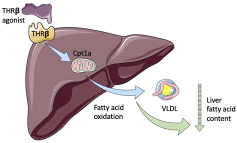 Understanding the Relationship between Nonalcoholic Fatty Liver Disease and Thyroid Disease