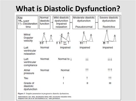 Image result for Moderate Diastolic Dysfunction