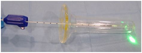 Assessment of the Efficacy and Safety of a Dual-Wavelength Diode Laser ...