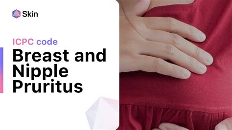 Breast Feeding Nipples Itch at Julia Kromer blog