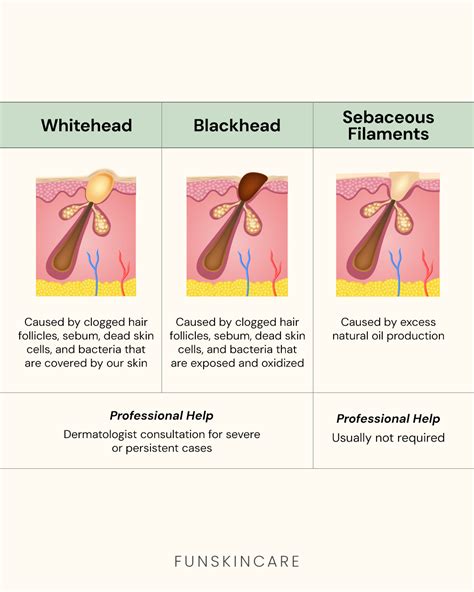 What causes sebaceous filaments to appear?