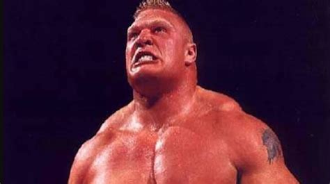 WWE Brock Lesnar Teeth Fixed Now? Before and Afters | LEMA