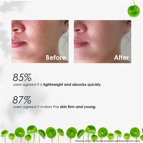 Multi-Action Night Repair Face Serum 3% Centella Asiatica Extract(cica ...