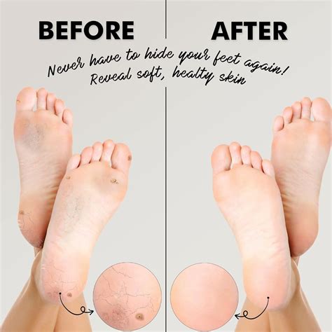 Buy Jairestone Foot Pumice Stone for Feet - Natural Earth Lava Pumice ...