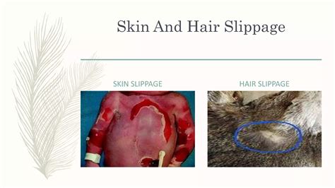 FORENSIC MEDICINE - STAGES OF DEATH | PPTX