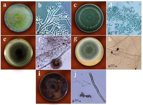 Endophytic Fungi as Potential Biocontrol Agents against Rhizoctonia ...